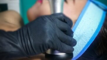 Hayfa Skin and Body Clinic's RF Arms treatment result in shapely extremities.