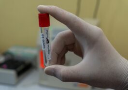 Saliva-Based COVID-19 Test